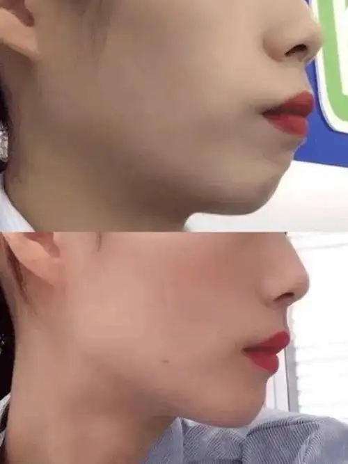 05被公认的超丑侧脸一回头毁掉整张脸看看是不是你60