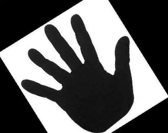 远程心脑管家帮您找出冠心病的"幕后黑手"--高血压