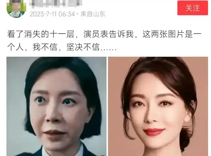 脸垮僵硬撞脸蔡明,整容后遗症出来了_面部_网友_双眼