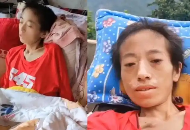 29岁女网红生4胎后患癌,浑身长蛆被婆婆赶出家,丈夫利用她赚钱