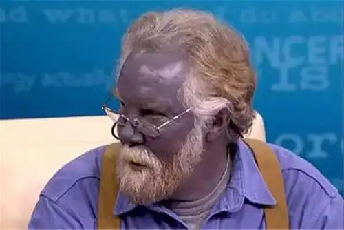 非洲部落的绿种人,血液和皮肤都是绿色,目前已不足3000人!