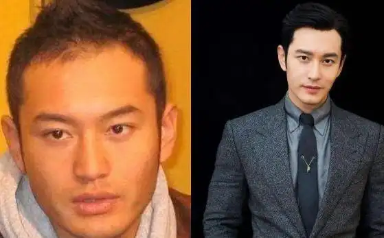 原创黄晓明属于英年早秃?浓密秀发被扒全是假的,对比旧照差距明显