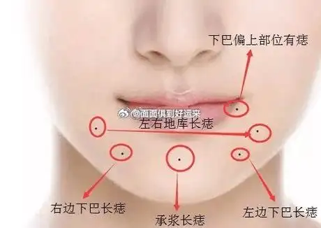 下嘴唇上面有痣