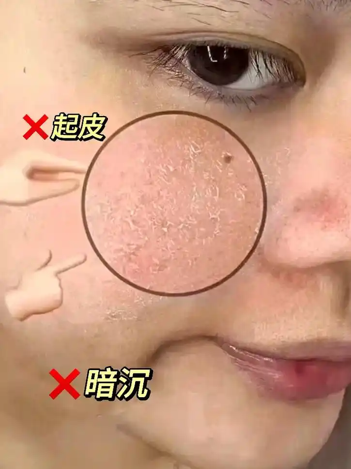 脸上起皮皮,皮肤暗沉粗糙缺水,显得老!那就试试#马来西亚甘 - 抖音