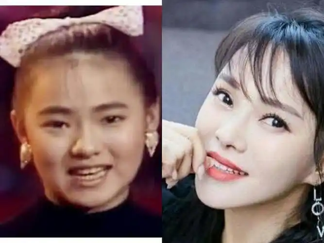 盘点割过双眼皮的明星