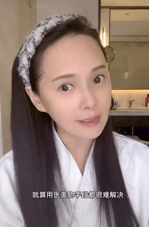 53岁伊能静出镜承认整容,直言从没否认,网友扒出早期动态秒打脸_女