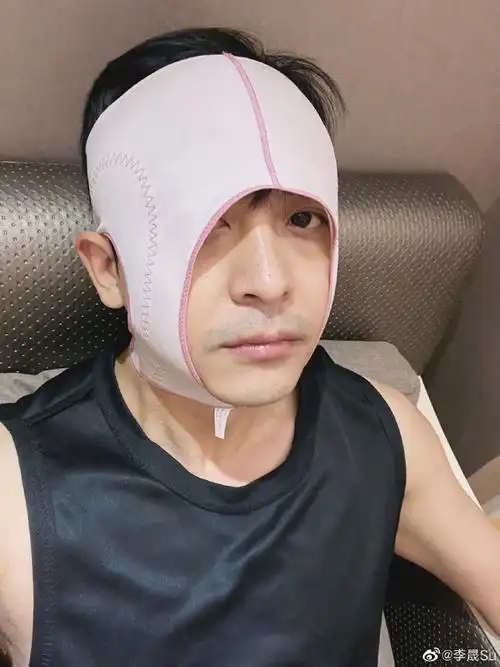 组图:李佳航戴反瘦脸神器卡喉咙 老婆李晟晒照吐槽表示心累
