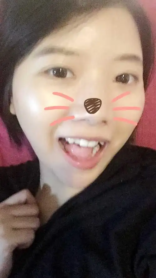 都说露八颗牙好看,可是如果有虎牙怎么笑?