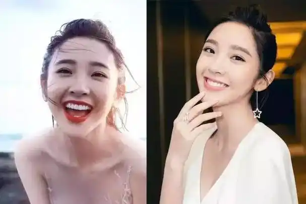 刘涛和杨紫谁最漂亮 盘点娱乐圈的假牙女明星(8)