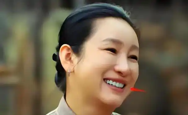 "烤瓷牙"上镜有多拉垮?嘴凸包不住,牙比灯还亮,演戏都没法看