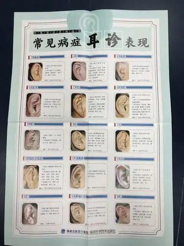 正版包邮 观耳诊病挂图 中医望诊系列挂图 2开高清挂图 图解耳诊书籍