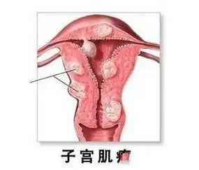 出现这些症状或预示妇科病找上门千万留心