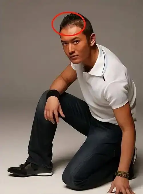 12位大神级别男星"秃顶"大赏:黄晓明,沙溢头顶稀疏,何止油腻