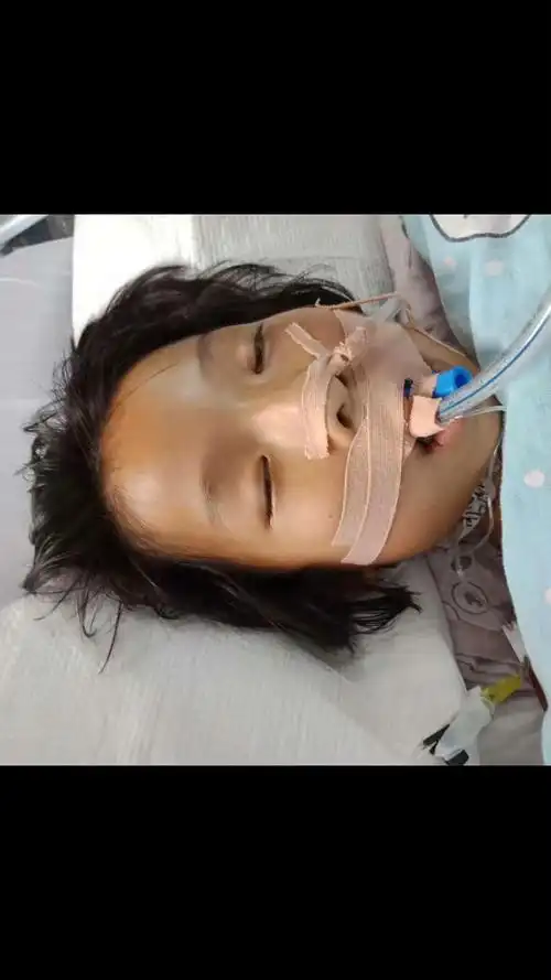 她今年才九岁,因患重症肺炎而住进了icu.