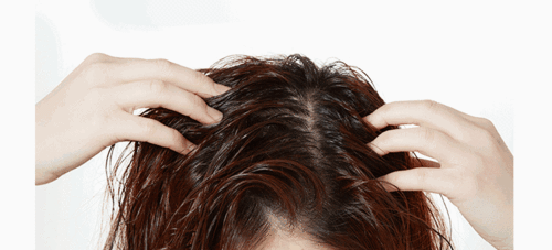 5款最有效的生发精华发际线后退和秃顶最可怕好看的人都开始在用这些