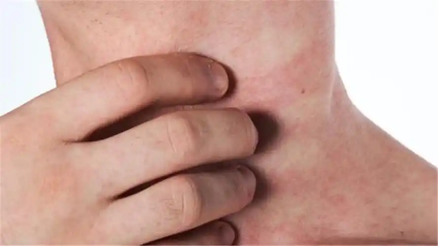 女大学生身患艾滋病:这三件事最好别做!最后一点很多女生喜欢!