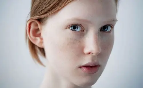 长斑根本原因:胶原蛋白流失,这几招,帮你彻底【下斑】!