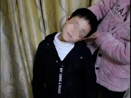 小儿斜颈也叫歪脖子,在幼儿发病率排前5名.