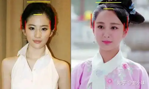 高颅顶是什么意思为什么增高颅顶可以增加颜值