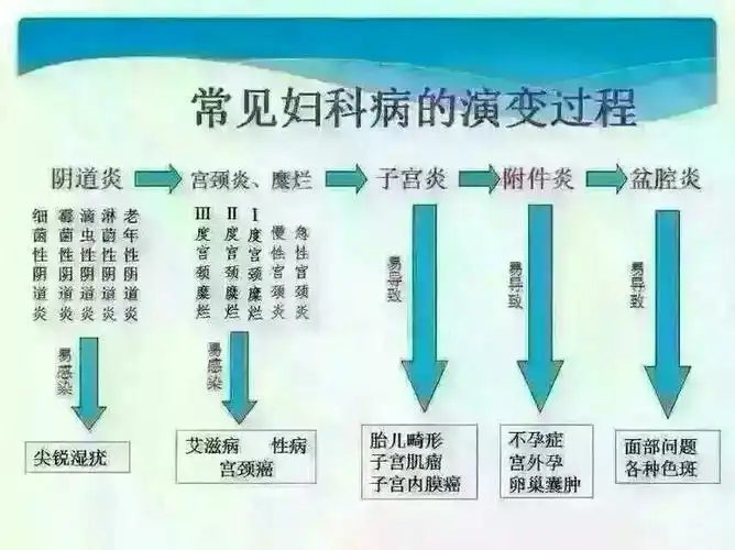如何有效预防妇科炎症的发生?