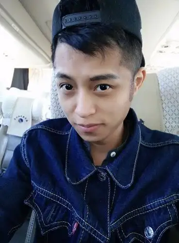 龟毛完美主义者刘桂彬霸气鬓角种植术后四天_广州倍生植发