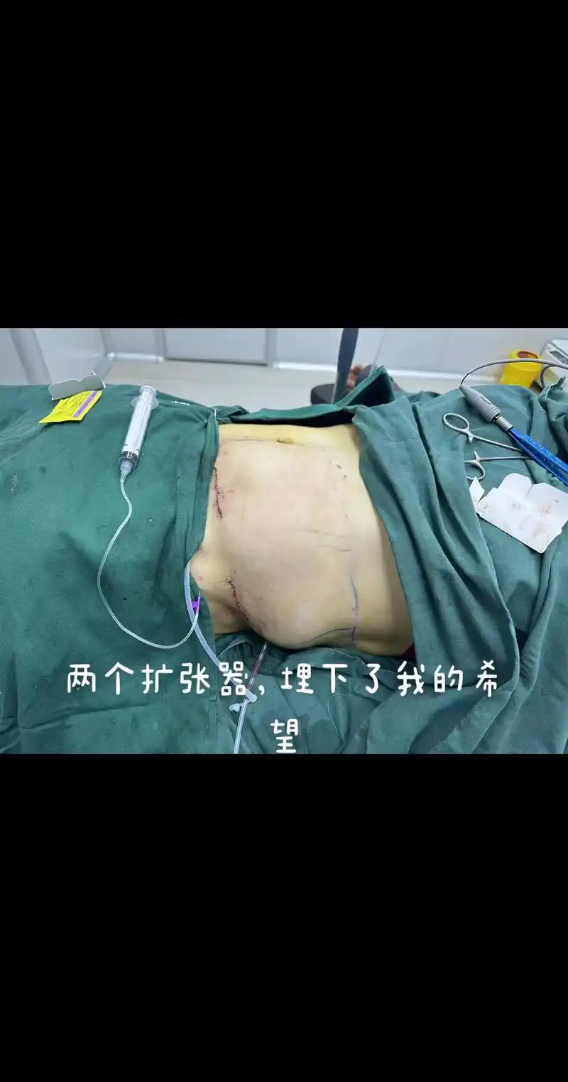 我的希望.术前一夜未眠,紧张,害怕,懊恼,怎么会受这么重的伤 - 抖音