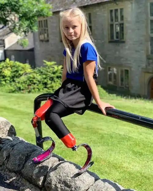 9岁无腿女孩力压世界名模登上t台惊艳时装周命运以