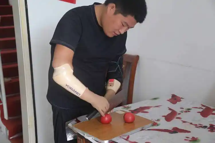 怎样让假肢保持干净?_袜子_穿戴_皮肤