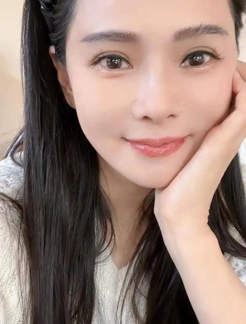 秦昊妻子伊能静韩国打水光针引发社会热议:美的追求与自然衰老的冲突