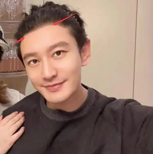 《中餐厅》开播后,有网友就指出黄晓明的假发套穿帮了,后脑勺头发非常