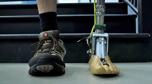 残疾人的福音!智能假肢踝关节,你也可以健步如飞!