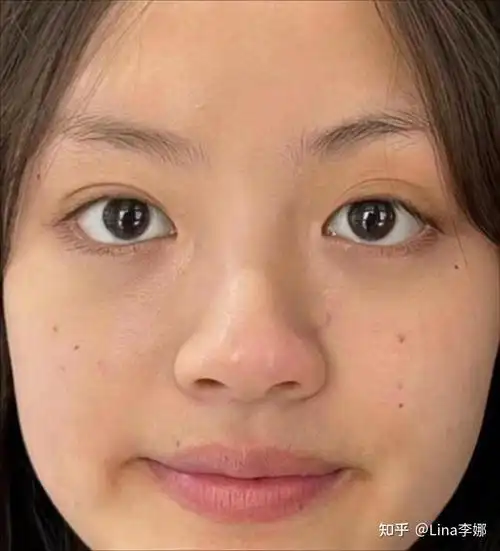 美白去黄好用到爆不愧是皮肤科医生中科院博士推荐的美白精华面霜一个