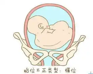 叶酸缺乏症是怎么引起的