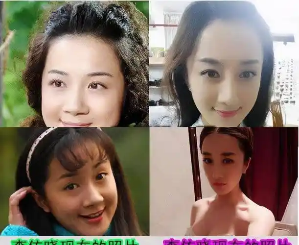 原创李依晓整容前后照片曾被叶璇狗咬过被曝已整容5次