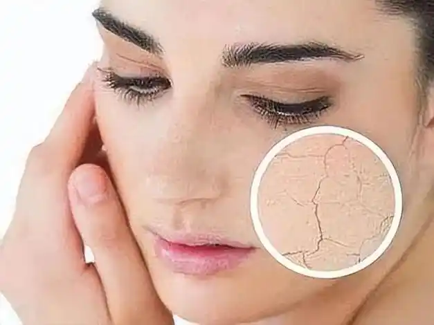 干性皮肤分为缺水性和缺油性?应该怎么护肤?