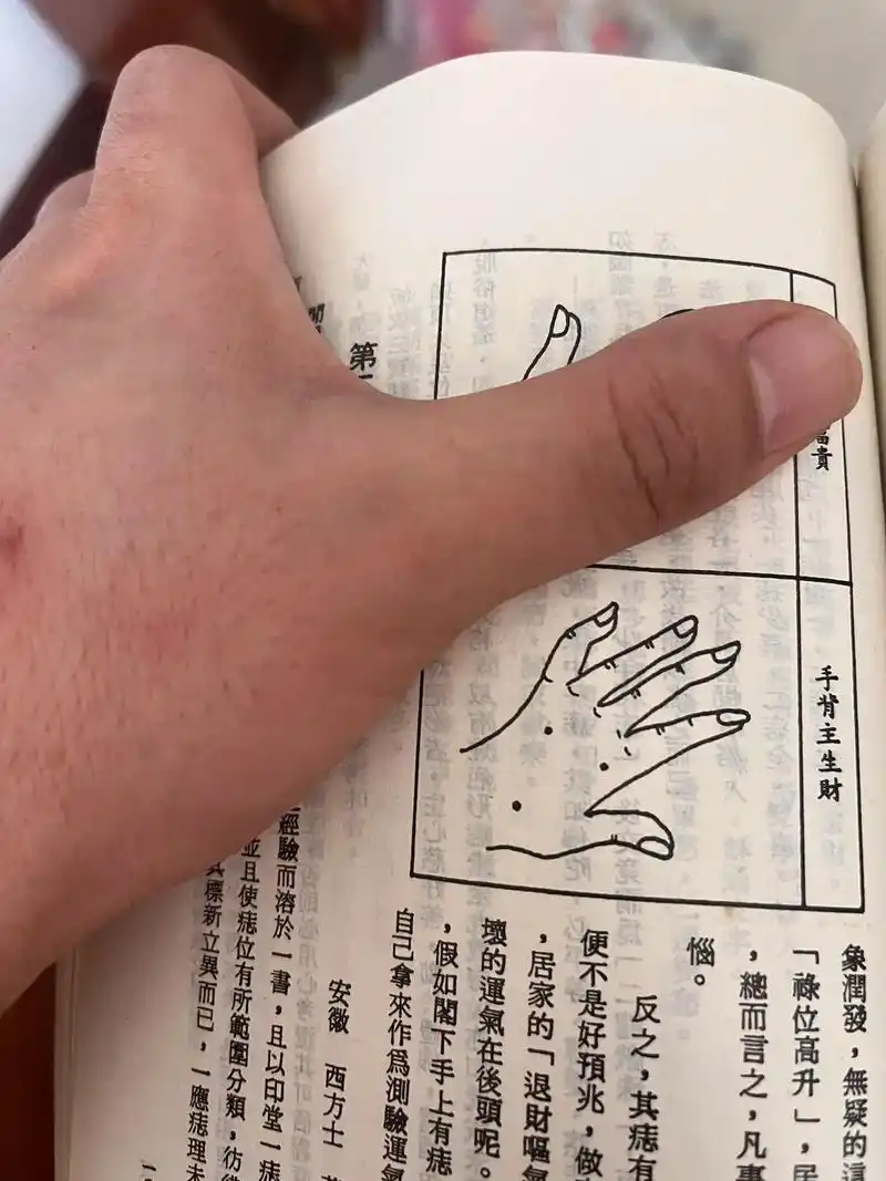 感谢网友提供素材.手背痣主生财.为好痣.但是图片 - 抖音