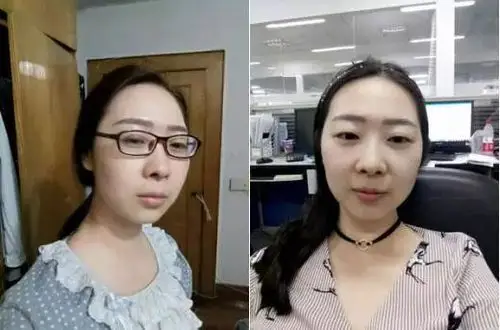 近视想要摘掉眼镜,不一定非要做手术!