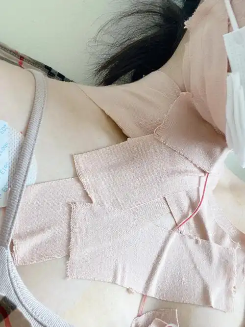 21岁和我的甲状腺saygoodbye