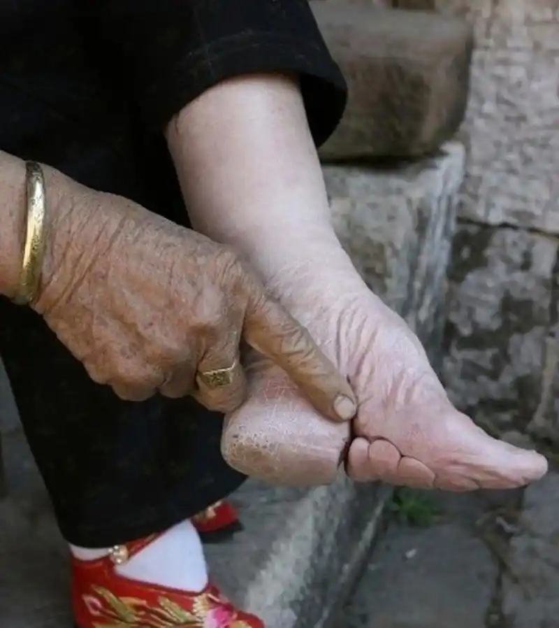 在中国古代,裹小脚似乎是汉族女性的一种普遍现象,不