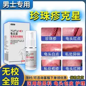 包皮炎消炎膏冠状沟珍珠疹粒丘疹去除霉菌性白沟异味红白点止痒