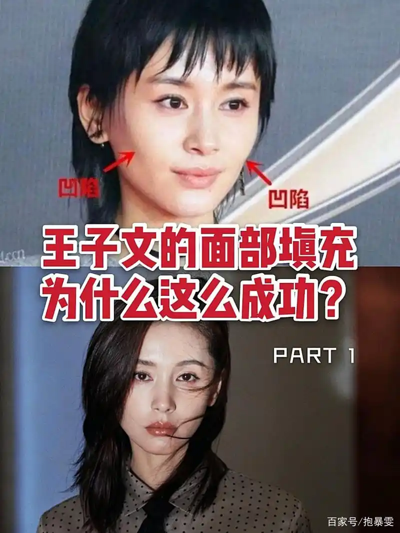 为什么王子文的填充如此成功?