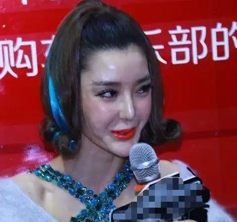 整容失败的女星,郑爽锥子脸,张檬面部僵硬,而她却付出了生命