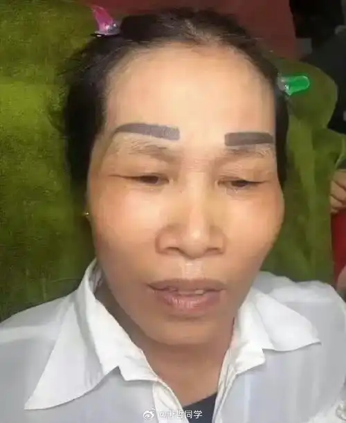 疫情过后的生意依然热火朝天,计划今年继续上整形项目.