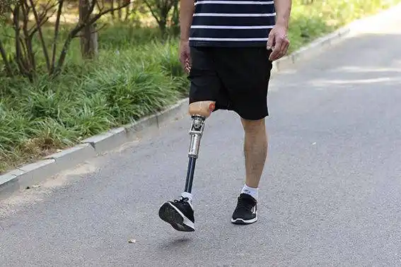 这四点决定大腿假肢适配度!_患者_进行_穿戴