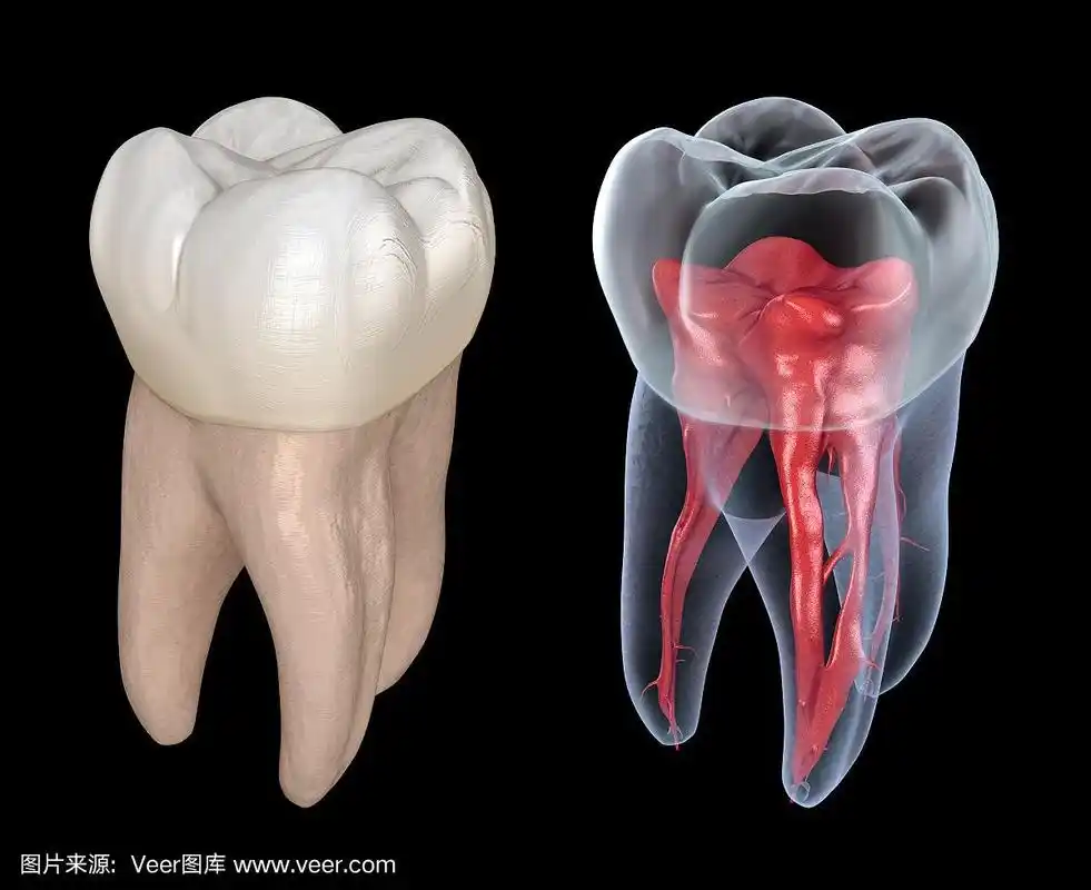 牙根解剖学-上颌第一磨牙.医学上准确的牙科3d插图