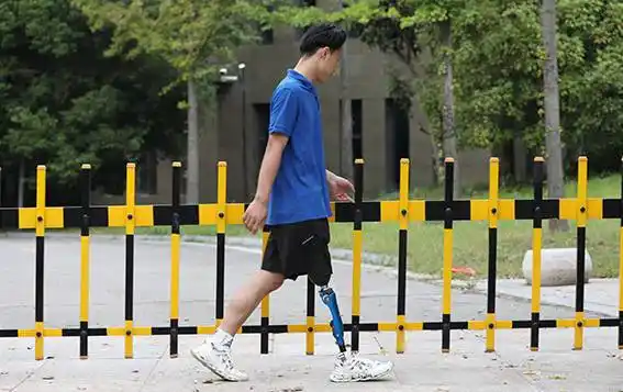 患者截肢后需要注意什么问题_训练_活动_假肢