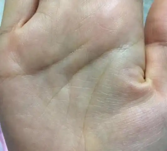 手相生命线呈现眼睛纹路年轻时老公嫌弃命中注定苦一世