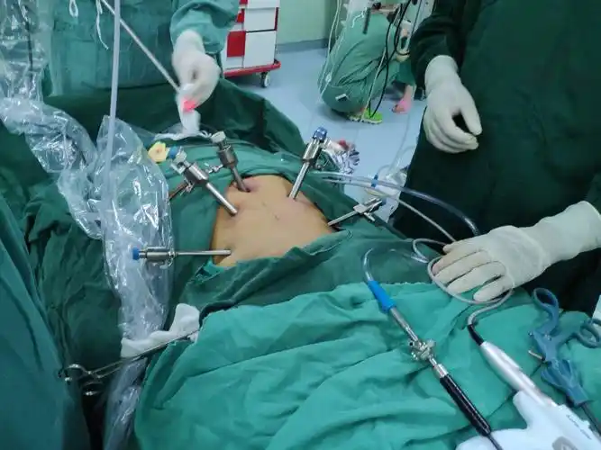 延大附院泌尿外科2018年微创手术再创新高
