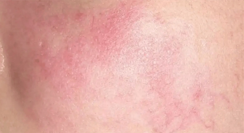 记住这几点就够了!_玫瑰_皮肤_护肤品