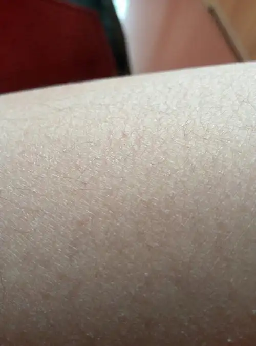 为什么我的腿上的皮肤粗糙呢,有什么办法快速让皮肤水灵灵?